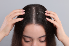 Este tratamiento, aplicado de manera constante, elimina el hongo y mejora el estado del cabello. Foto: Archivo