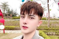 El joven vietnamita luego de las nueve operaciones en su cara