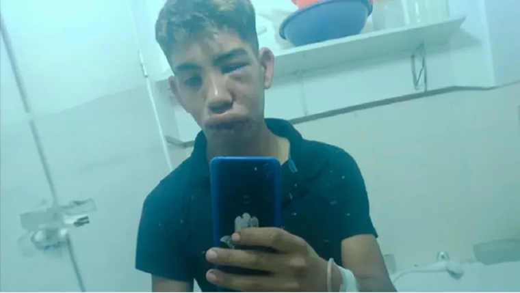 Así quedó la víctima tras la golpiza Foto: Gentileza