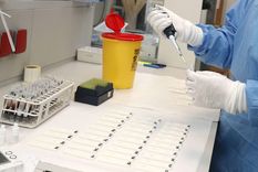 El servicio de laboratorio está en riesgo, indican los bioquímicos mendocinos Foto: Archivo MDZ