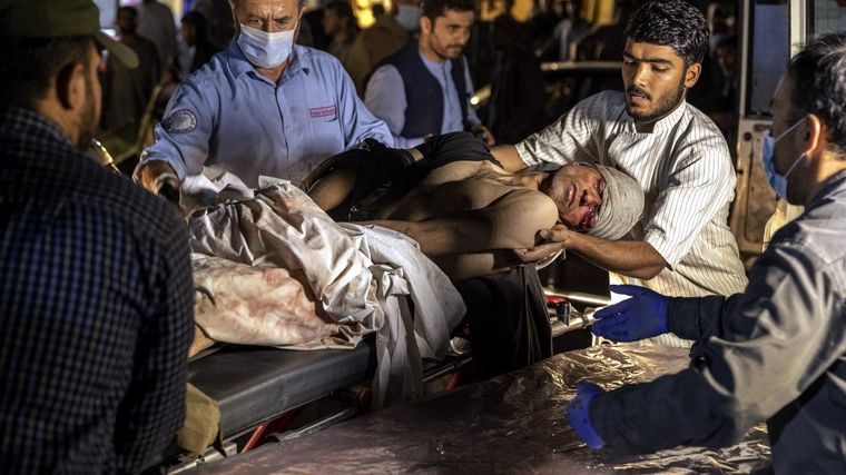 Uno de los heridos graves. Foto: The Boston Globe.