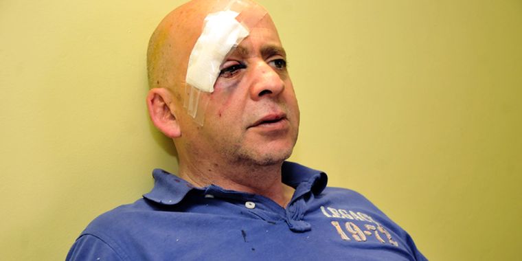 Imagen de Guerra tras la paliza. Foto: Mediamza.com