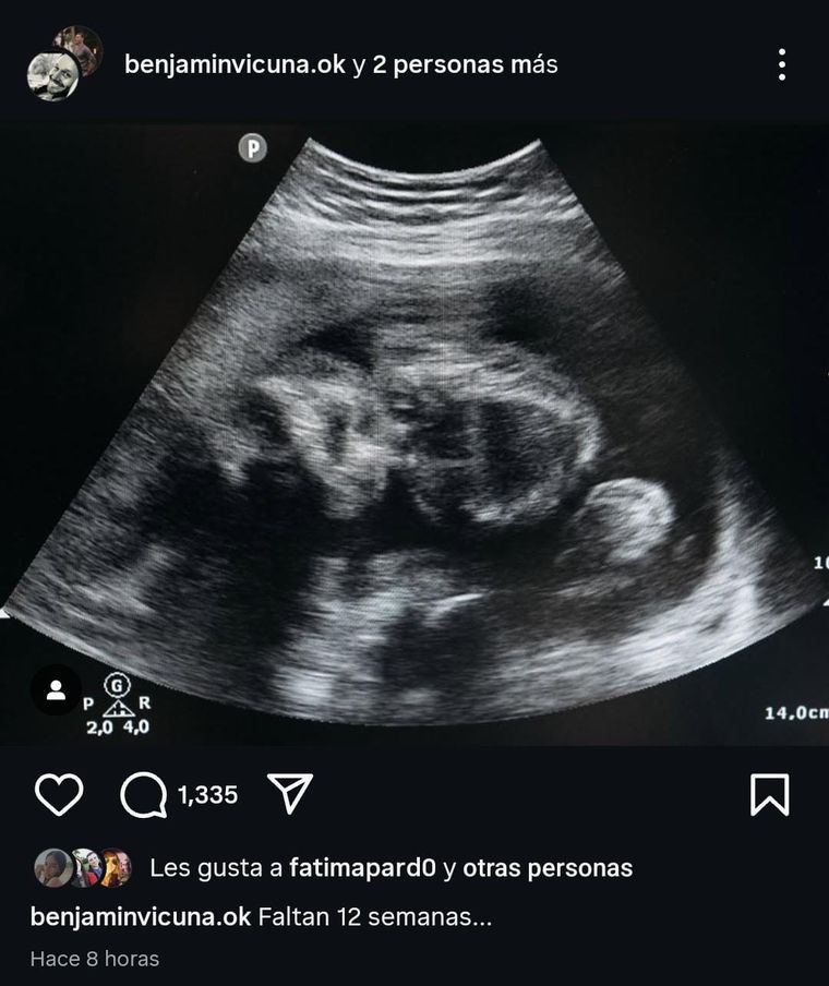 La publicación de Benjamín Vicuña que desató el enojo de muchos. Créditos: Instagram / @benjaminvicuna.ok La publicación de Benjamín Vicuña que desató el enojo de muchos. Créditos: Instagram / @benjaminvicuna.ok