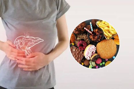 Cómo cuidar tu hígado graso de diferentes alimentos.