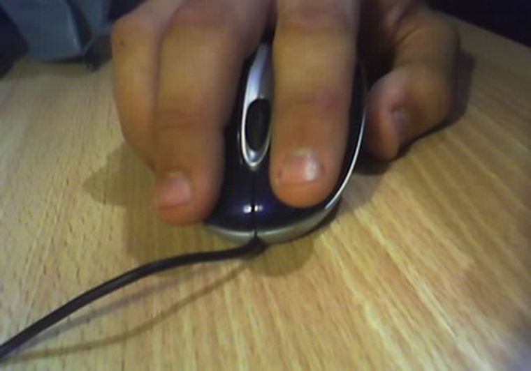 No utilizar almohadilla para el mouse, agrava el problema. Foto: web