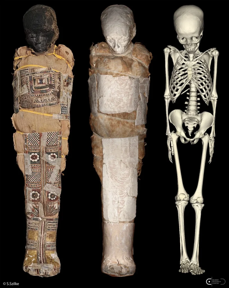 Hallazgo arqueológico en Egipto: la imagen muestra la momia de un niño de unos 2.000 años junto a la reconstrucción de su interior, clave para detectar el objeto oculto en el pecho. Hallazgo arqueológico en Egipto: la imagen muestra la momia de un niño de unos 2.000 años junto a la reconstrucción de su interior, clave para detectar el objeto oculto en el pecho.