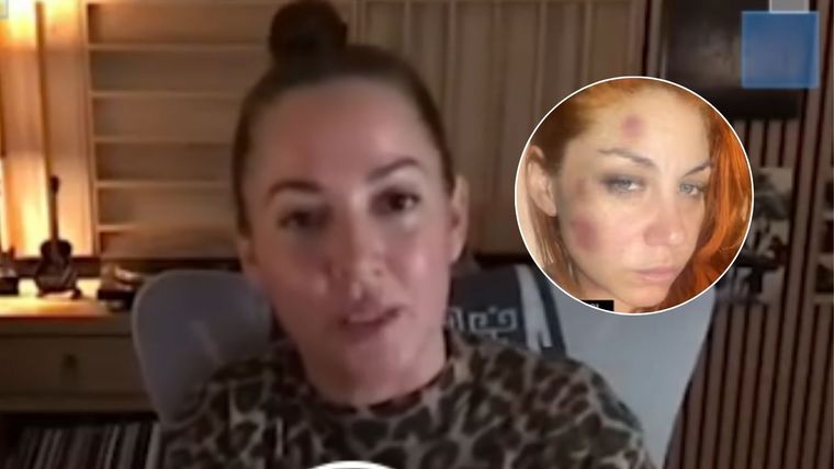 Valeria Gastaldi reveló los maltratos en Telenoche. / Captura de pantalla&nbsp;