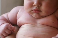 argentina, primera en obesidad infantil