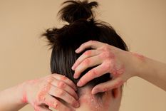 Argentina es el segundo país de Latinoamérica en aprobar esta nueva terapia que consiste en una dosis oral diaria Foto: Freepik Argentina es el segundo país de Latinoamérica en aprobar esta nueva terapia que consiste en una dosis oral diaria Foto: Freepik