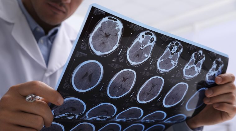 Las tomografías ayudan a detectar patologías en tórax, abdomen, pelvis, pulmón, hígado, riñón, ovarios y páncreas Foto: Shutterstock
