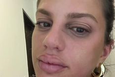 Una tiktoker se hizo viral luego de contar por las redes sociales que quedó internada por comer una conocida golosina que compró suelta en un kiosco. Foto: Captura de video