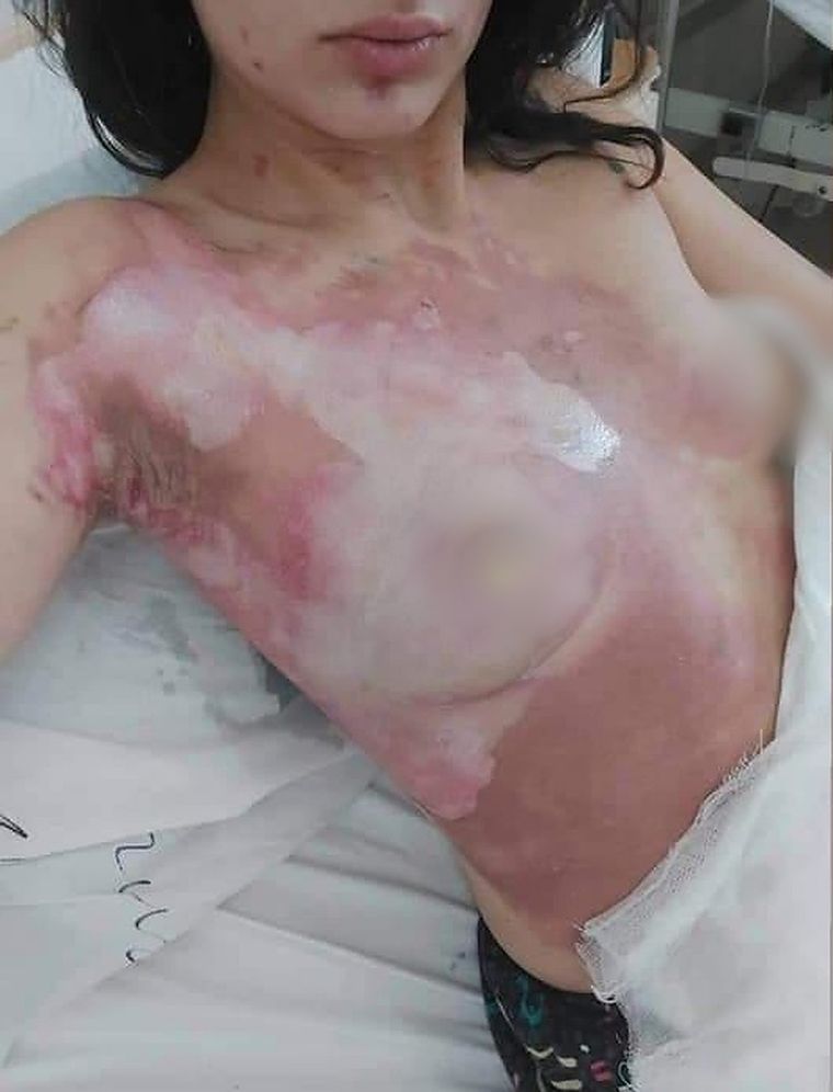 Así quedó la joven tras ser atacada por su pareja