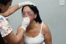 La víctima del brutal ataque Foto: Redes sociales La víctima del brutal ataque Foto: Redes sociales
