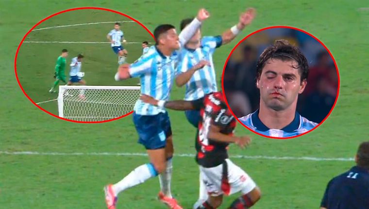 Marcos Rojo tuvo un accidentado final de partido.