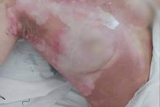 Así quedó la joven tras ser atacada por su pareja