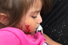 El rostro de la pequeña tras el ataque del perro que su dueña no quiso reconocer
