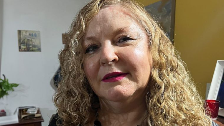 Marisa Giordano comparte su historia y cuenta cómo es vivir con trastorno bipolar.&nbsp;