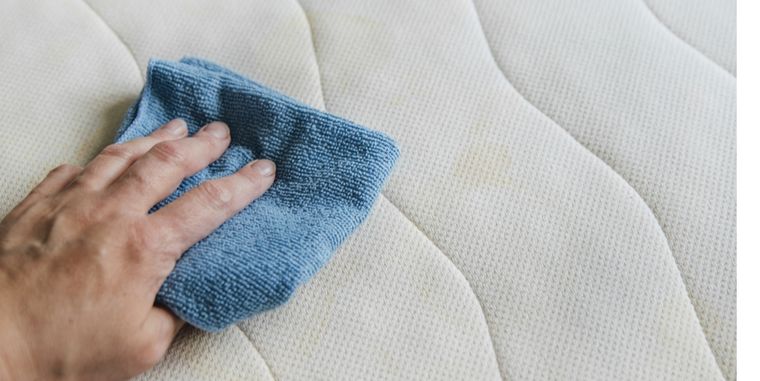 Es común que se generen estas manchas con el paso del tiempo Foto: Shutterstock