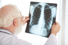 El aumento de casos de tuberculosis fue con una velocidad de más del 20% anual respecto al brote del 2021. Foto: Freepik