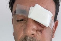 Así quedó la víctima tras la agresión Así quedó la víctima tras la agresión