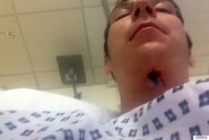 se hizo un blanqueamiento dental y mira lo que le paso en la garganta