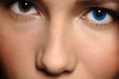 Un tratamiento con láser puede cambiar el color de tus ojos