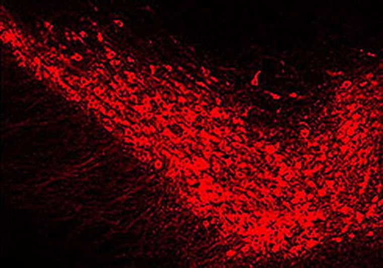 El Parkinson se origina por la muerte de las neuronas que producen dopamina, un neurotransmisor que controla los movimientos.