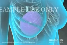 mira en video como fue la operacion de angelina