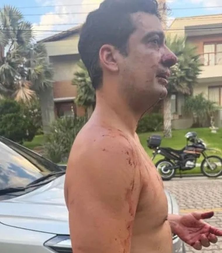 Eros Mancuso quedó en el centro de la polémica en Brasil. Eros Mancuso quedó en el centro de la polémica en Brasil.