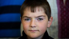 Algunos niños, como Dennis (en la imagen), llegaron al complejo de Tarará en Cuba para recibir tratamiento para sus dolencias médicas tras la catástrofe de Chernobyl. Algunos niños, como Dennis (en la imagen), llegaron al complejo de Tarará en Cuba para recibir tratamiento para sus dolencias médicas tras la catástrofe de Chernobyl.