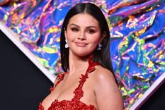 Los cambios físicos de Selena Gomez tienen que ver con la enfermedad que padece desde hace años.