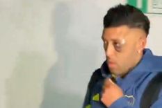 El delantero se mostró con el ojo morado y un corte en la ceja. Foto: Captura El delantero se mostró con el ojo morado y un corte en la ceja. Foto: Captura