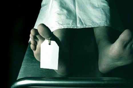 La Universidad París-Descartes fue acusada de dejar los cuerpos y restos humanos a merced de las ratas. Foto: BBC Mundo