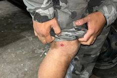 Así quedó la pierna del uniformado Foto: Noticias argentinas