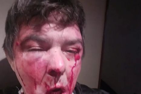 Asi quedó el encargado del edificio tras el ataque