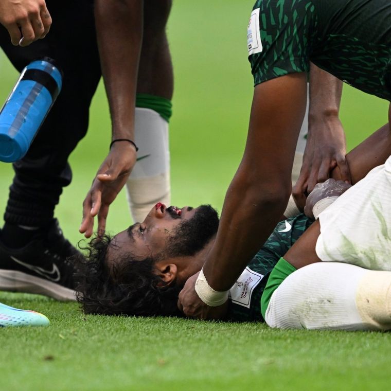 Yasser Al Shahrani es atendido tras recibir el duro golpe. Foto: EFE