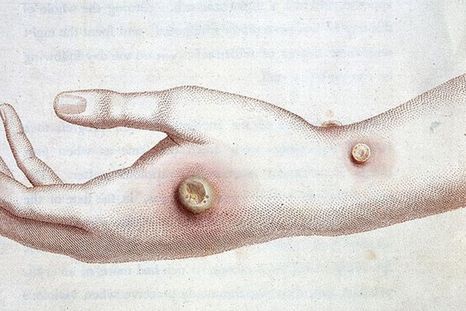 Se infecta con virus del siglo XVIII tras alimentar a varios terneros