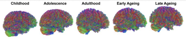 Imagen del estudio que muestra cómo cambia la organización del cerebro en sus cinco etapas principales: niñez, adolescencia, adultez, envejecimiento temprano y envejecimiento tardío. Imagen del estudio que muestra cómo cambia la organización del cerebro en sus cinco etapas principales: niñez, adolescencia, adultez, envejecimiento temprano y envejecimiento tardío.