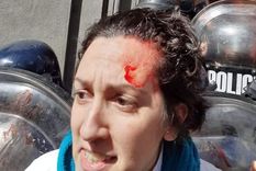 incidentes en la puerta de la legislatura portena en una protesta de trabajadores de la salud