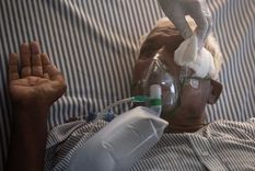 La mucormicosis afecta los senos nasales y puede requerir la extirpación quirúrgica del ojo. Foto: GETTY IMAGES