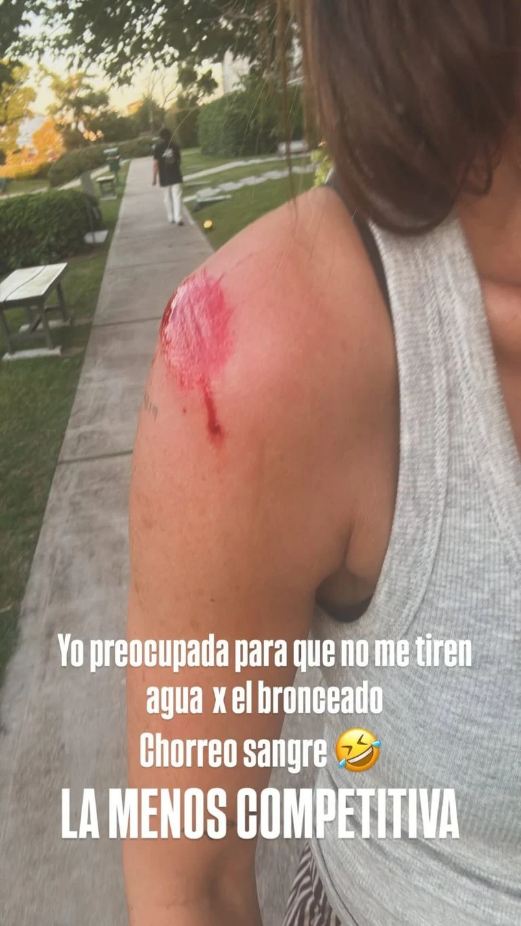 El percance de la modelo que no pasó desapercibido. Créditos: Instagram El percance de la modelo que no pasó desapercibido. Créditos: Instagram