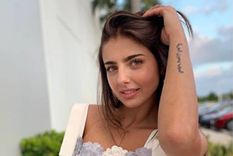 el dia que michelle renaud enfrento los estereotipos de belleza por su salud