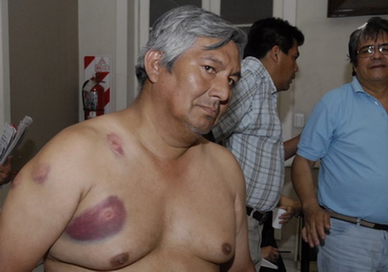 Los trabajadores rurales sufrieron golpes por la protesta Foto: Marcelo Ruiz / MDZ