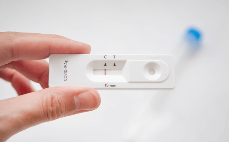 El autotest podrá adquirirse en las farmacias del país.