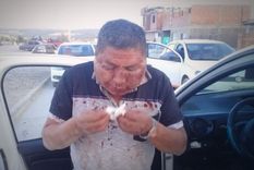 Así quedó El taxista sufrió una tremenda golpiza. Foto: diario TiempoSur