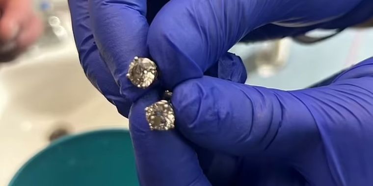 Los aros que se robó y tragó el ladrón. Foto: Departamento Policial de Orlando