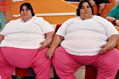 murio valeria, una de las mellizas de cuestion de peso