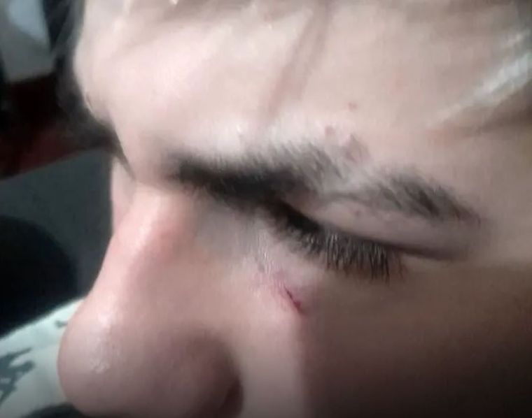 Una madre denuncia a dos patovicas por agredir a su hijo.