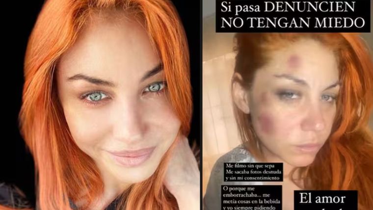 Lourdes de Bandana preocupó a su familia. Lourdes de Bandana preocupó a su familia.