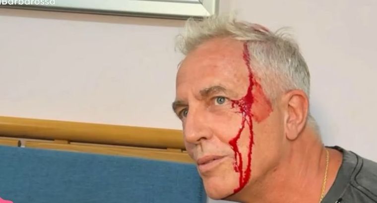 El periodista Fede Flowers compartió fotos del preocupante accidente que sufrió Marley. El periodista Fede Flowers compartió fotos del preocupante accidente que sufrió Marley.